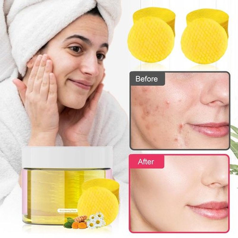 Turmeric Kojic Acid Cleansing Pads, 2025 New Sugar Turmeric Cleansing Pads for Face Turmeric Kojic Acid Pads, Upgrade 55Pcs Turmeric Pads Infused Foaming Exfoliating Pads (Yellow*3, One Size)