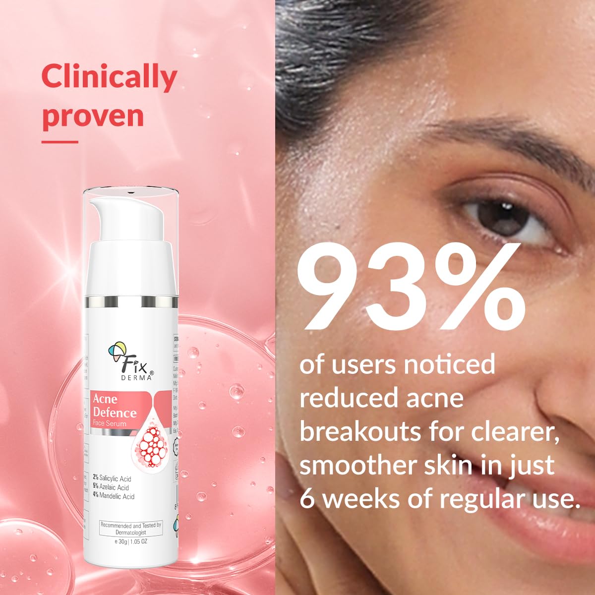 Fixderma 2% Salicylic Acid Serum for Anti Acne & Spot Treatment with 5% Azelaic Acid & 4% Mandelic Acid | Anti Acne Face Serum for Men & Women | For Oily Skin - 30g