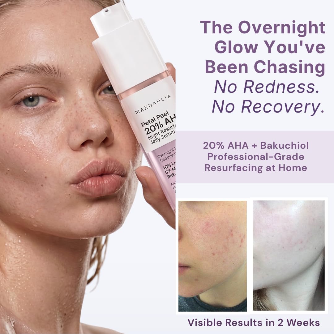 MAXDAHLIA Petal Peel 20% AHA Serum – Lactic + Mandelic Acid Chemical Peel for Dark Spots & Acne Marks | Bakuchiol Night Treatment | No Downtime | Safe for Sensitive & Acne-Prone Skin