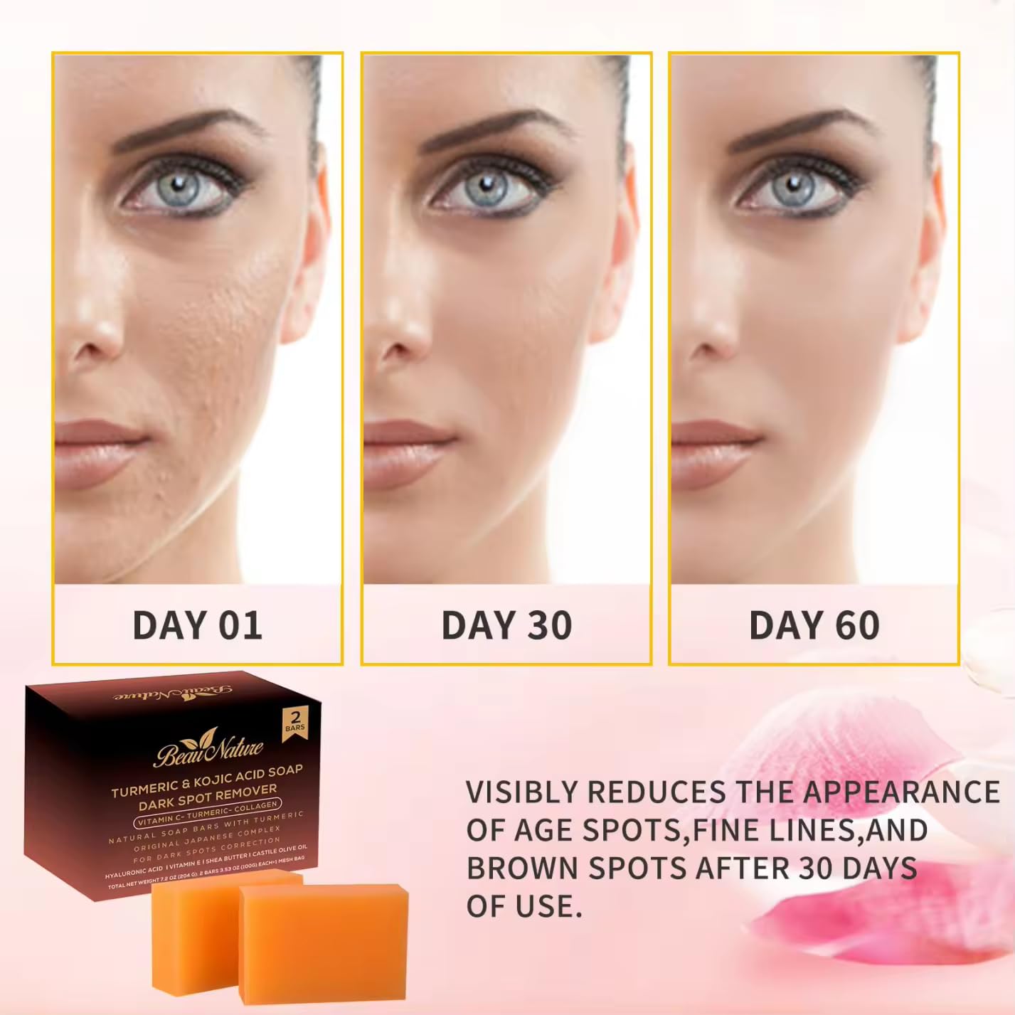Beau Nature Kojic Acid Turmeric Soap Bar - Dark Spot Remover for Face Even Skin Tone, Moisturizing & Nourishing Natural Ingredients 2 Bars