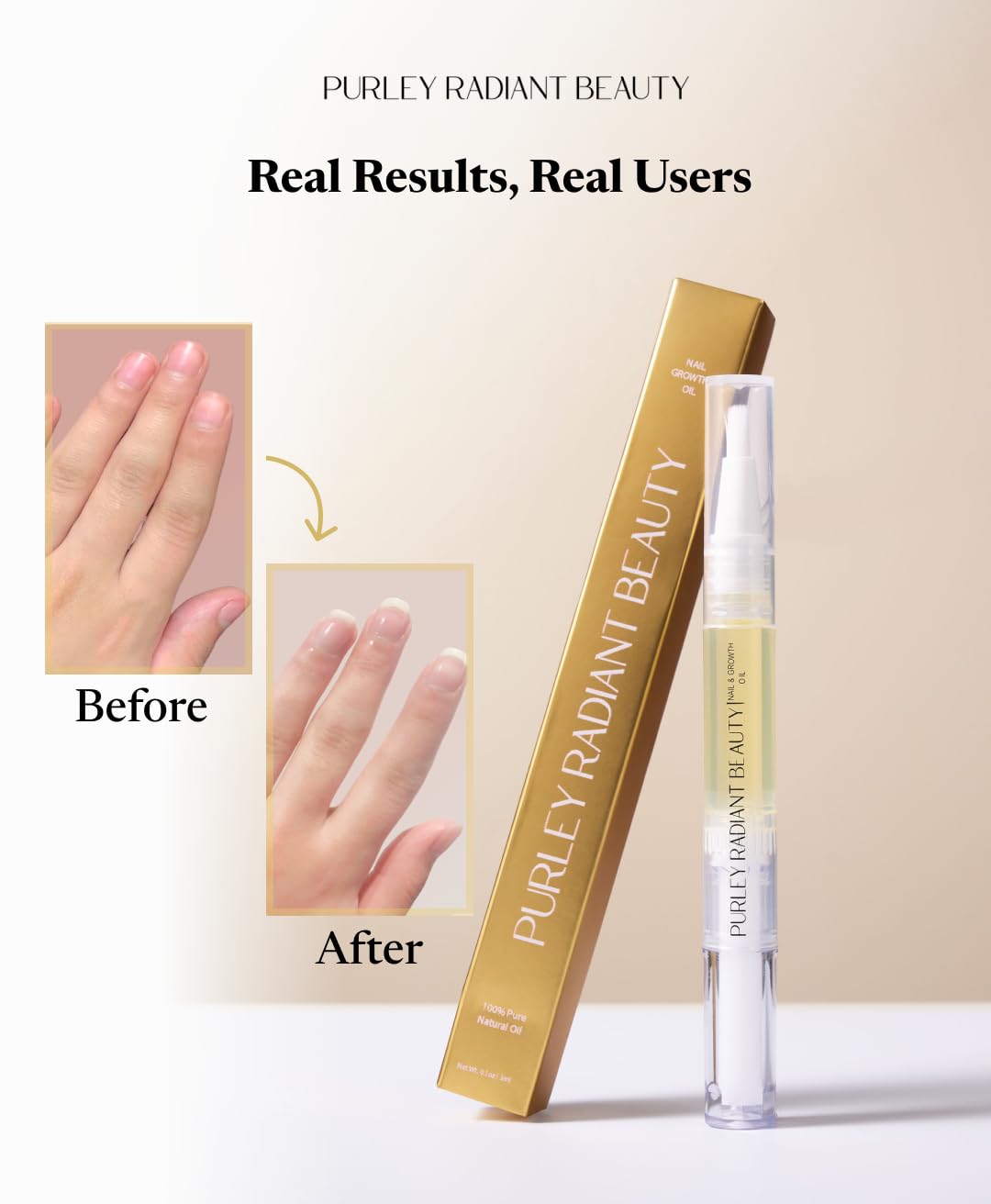 Purely Radiant Beauty Nail Growth Oil – Natural Cuticle Serum for Stronger Nails & Healthy Growth | Jojoba, Castor, Coconut & Argan Oils | Prevents Breakage, Peeling & Brittleness (3ml)
