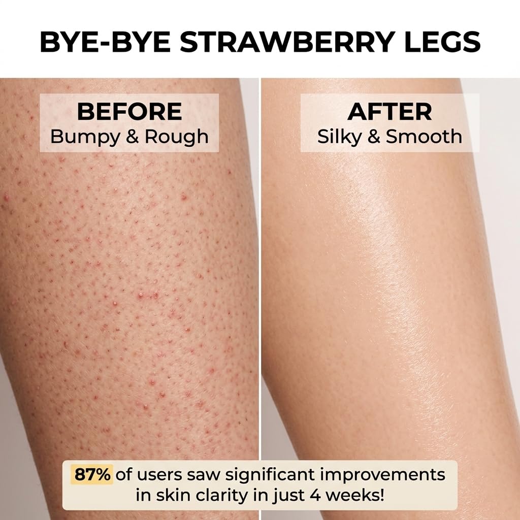 Strawberry Skin Treatment, Trystrawberry Legs Resurfacing Cream, Advanced Triple-Acid Complex For Keratosis Pilaris, Reduce Chicken Skin Bumps