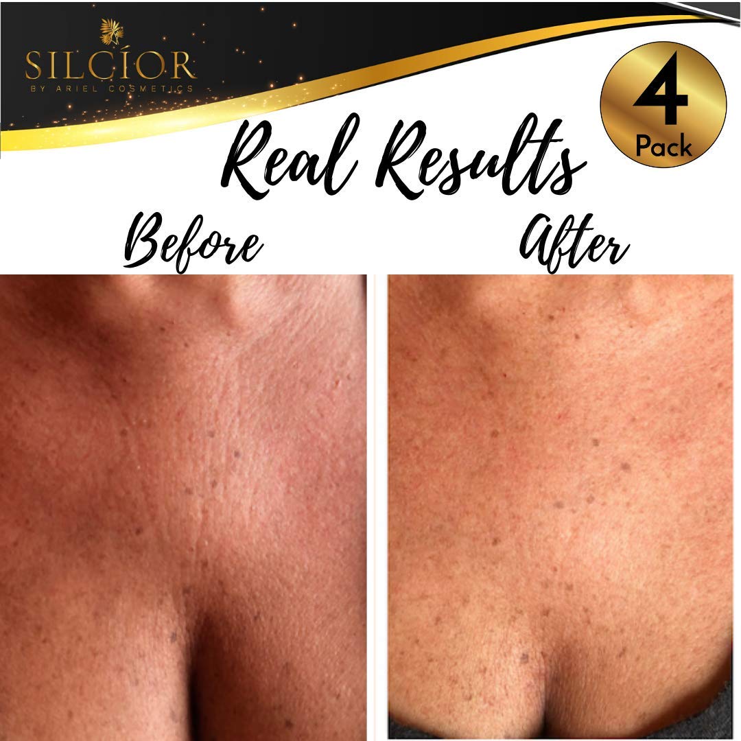 SILCIOR 4 PACK Chest Wrinkle Pads, Silicone Chest Pad, Decollete Anti Wrinkle, Chest Wrinkle Pads Sleeping Reusable, Chest Patches