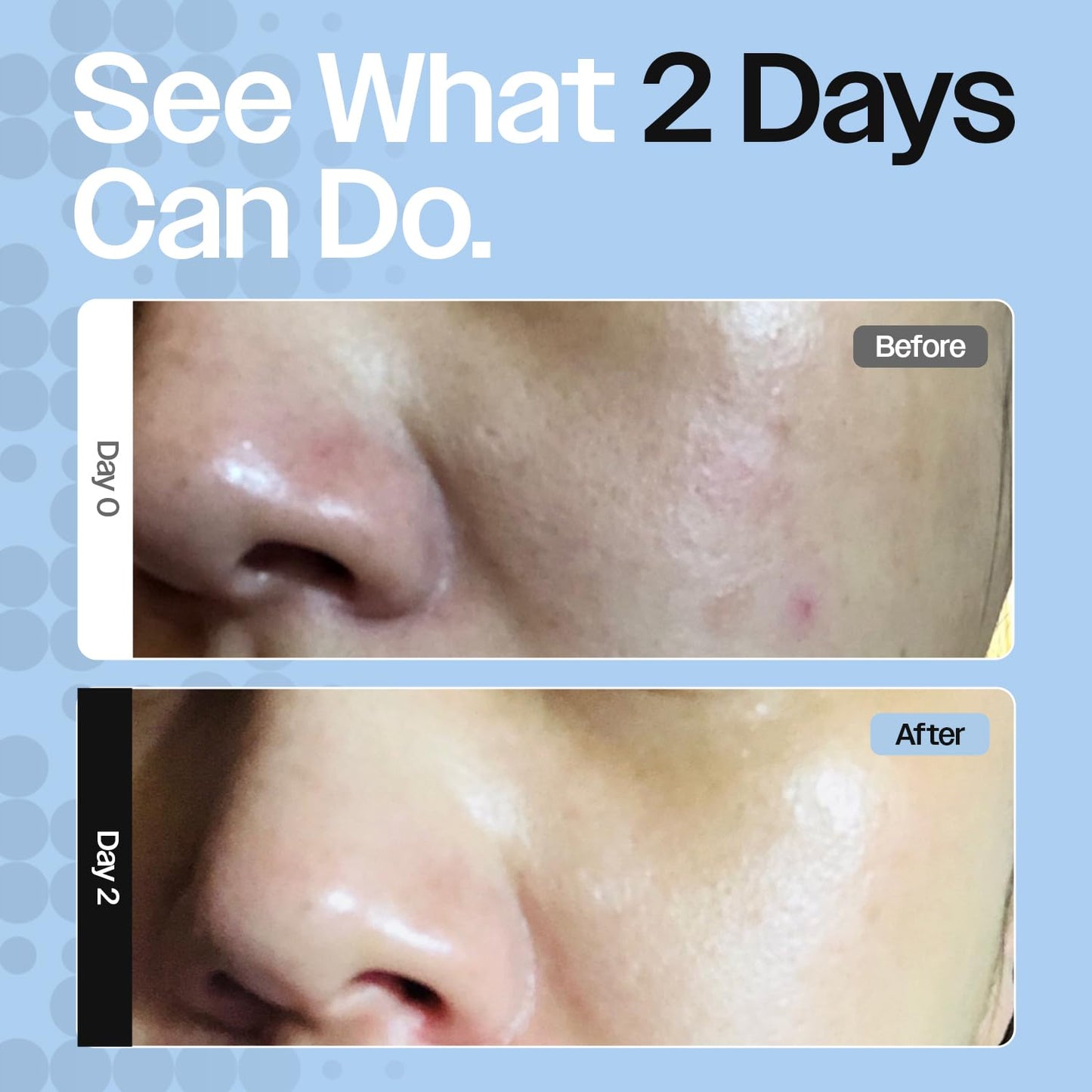 CELRIV Barrier Repair Cream for Dry, Sensitive & Eczema-Prone Skin, Clinically Proven +300% Hydration, Lightweight Non-Greasy 24HR Moisturizer, Dermatologist Tested, EWG VERIFIED™, Fragrance Free