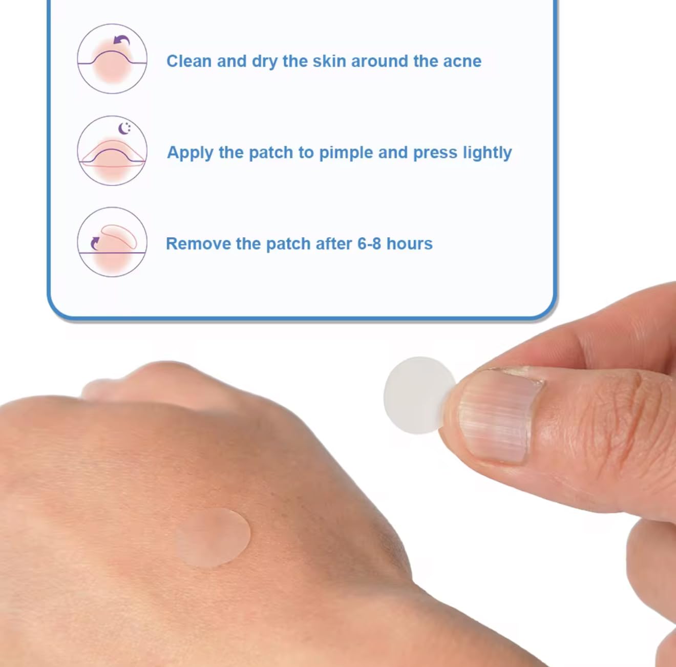 Acne Pimple Patches (144 Count) – Hydrocolloid Acne Patches for Face, Invisible & Waterproof, Fast Absorbing Zit Stickers for Pimples, Blemishes & Whiteheads – Day & Night Treatment