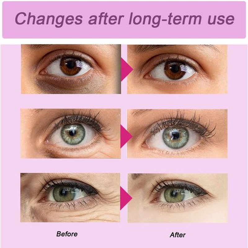 Eye Pad, Gel Eye Pad Cold Eye Mask Hot Cold Compress Reusable Gel Eye Pads Treat Eye Swelling