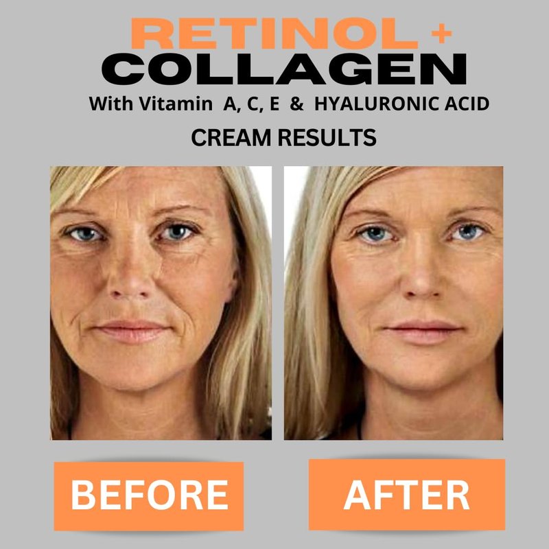 Retinol + Collagen Anti-Aging Face Cream | Hyaluronic Acid & Vitamin C Moisturizer - 4oz