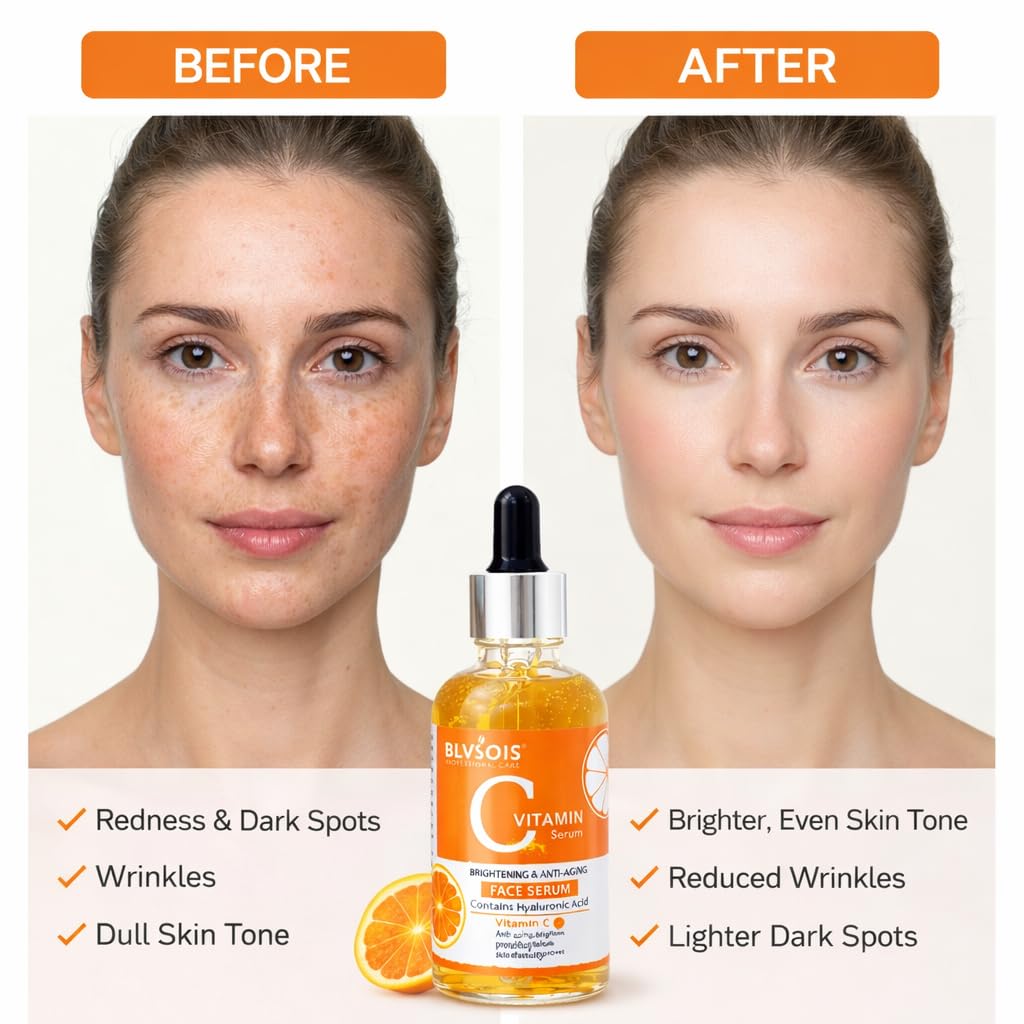 Vitamin C Serum For Face – Anti Aging Formula with Vitamin C, Hyaluronic Acid, Vitamin E – Brightening Serum – Improve Appearance of Dark Spots, Tone, Fine Lines & Wrinkles,