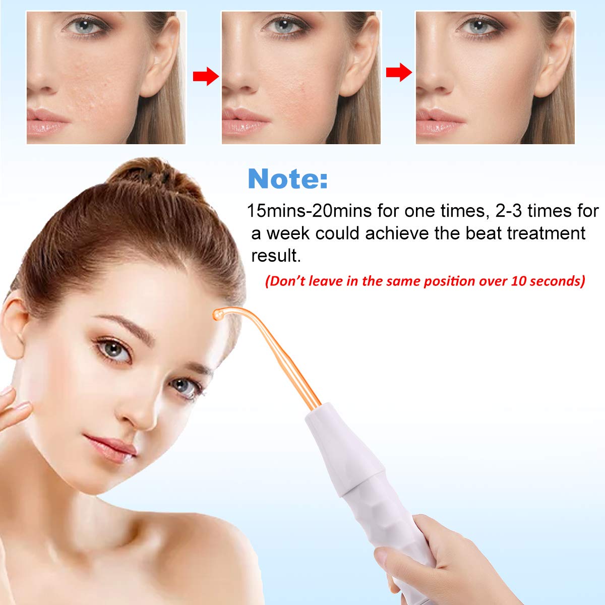 MYSWEETY High F Rrequncy Portable Handheld Facial Skin Care Wand Machine