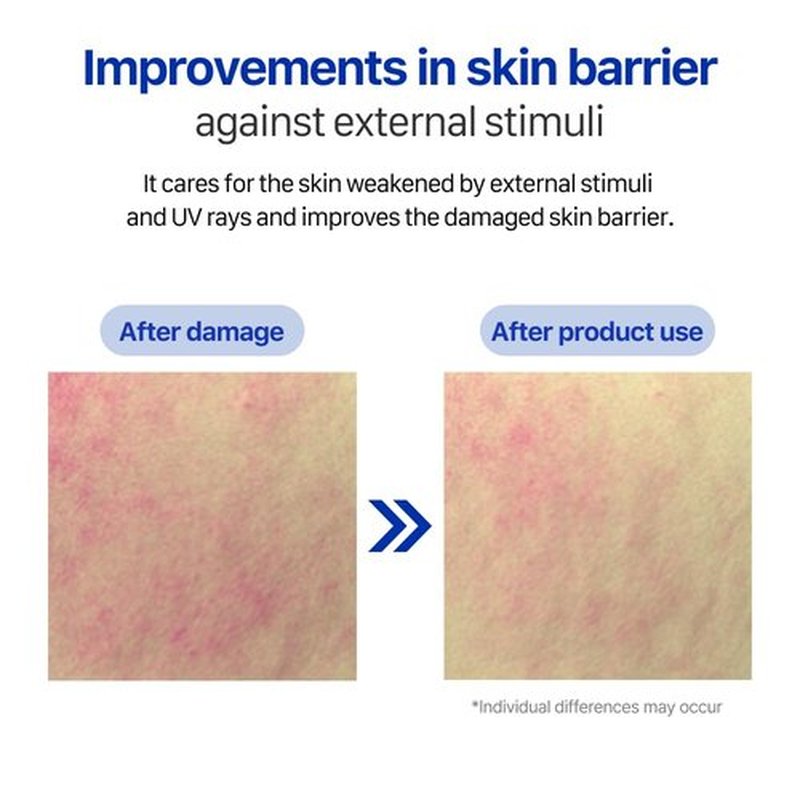 Real Barrier Extreme Cream Face Mask x 10ea | Skin Barrier Repair | Face Mask Skin Care | Moisturizing Relief Skin Care Solution for Dry Skin | Facial Moisturizer for Sensitive Skin | K-Beauty