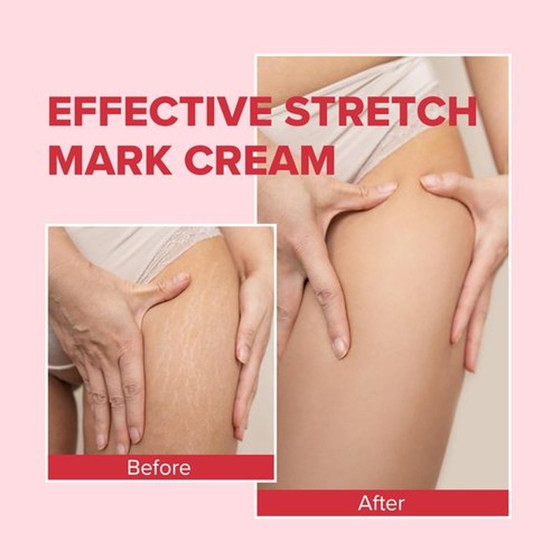 Enaskin Naturals Belly Firming Cream: Hibiscus & Honey Skin Tightening Cellulite Cream - Women Body Lotion for Firmness and Lift of Thighs & Stomach - Tummy Butter Stretch Marks - 100ML