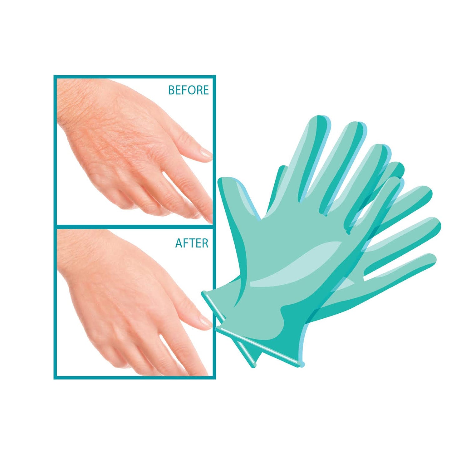 Dermactin-TS Crepe Be Gone Intense Hydration Smoothing Hand Mask - Moisturizing Gloves Hand Skin Repair, Collagen Hand Mask