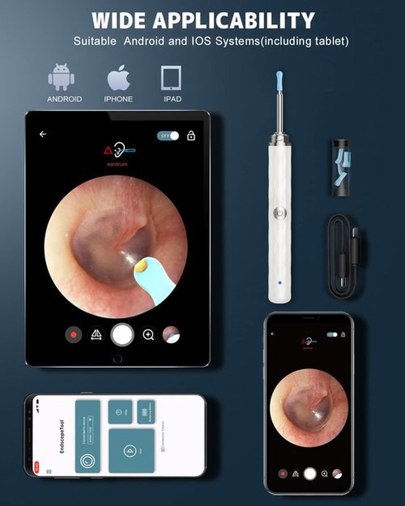 Ear Wax Removal, Ear Cleaner with Camera and Light, Ear Wax Removal Kit with 1296P Otoscope, Ear Cleaning Tool with 6 Ear Spoon, Ear Camera for iPhone & Android Phones,White