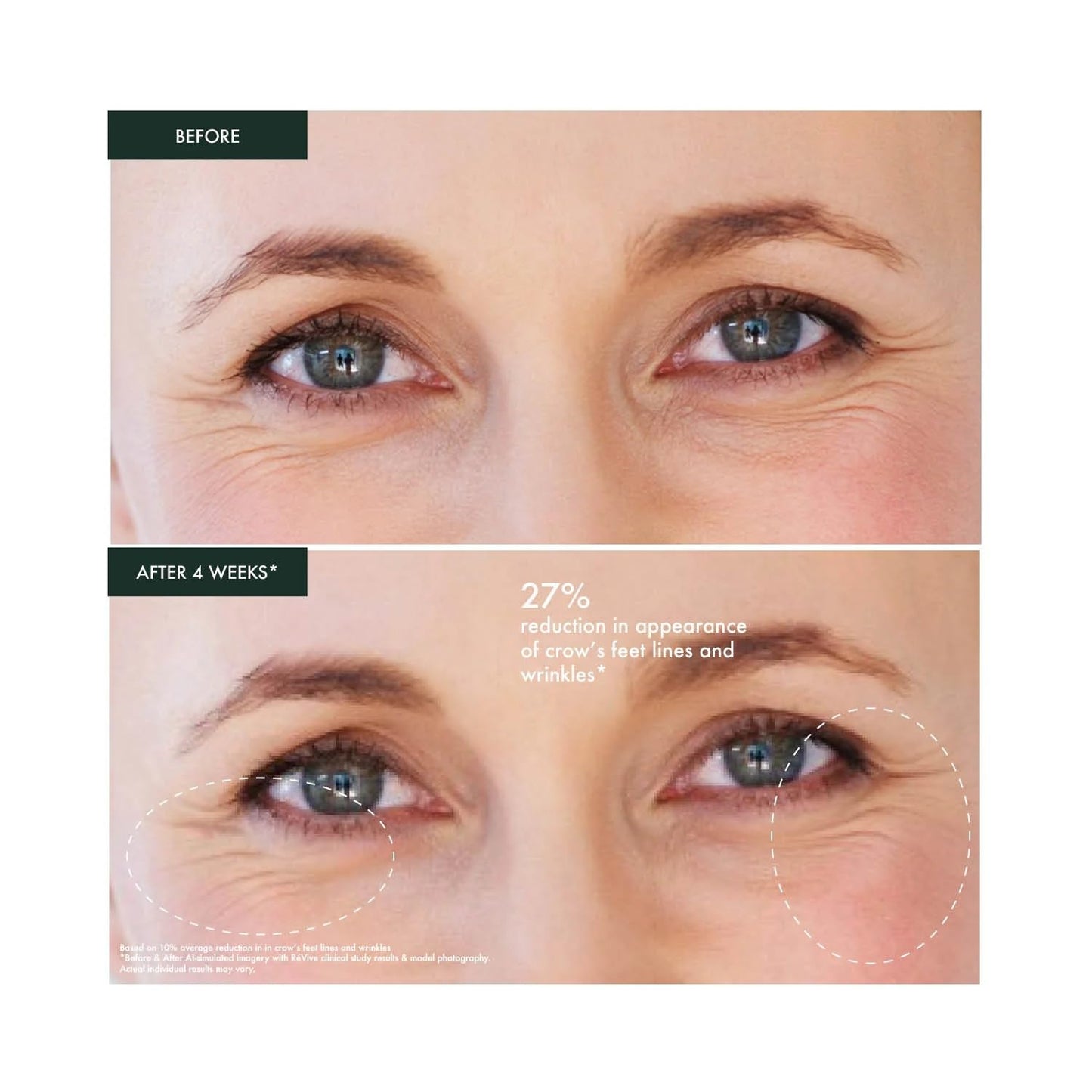 RéVive Renewal Under Eye Cream - Retexturizing Eye Cream for Wrinkles - Helps to Reduce Crow's Feet and Improve Skin Texture & Moisturization - Suitable for All Skin Types (0.5 oz)