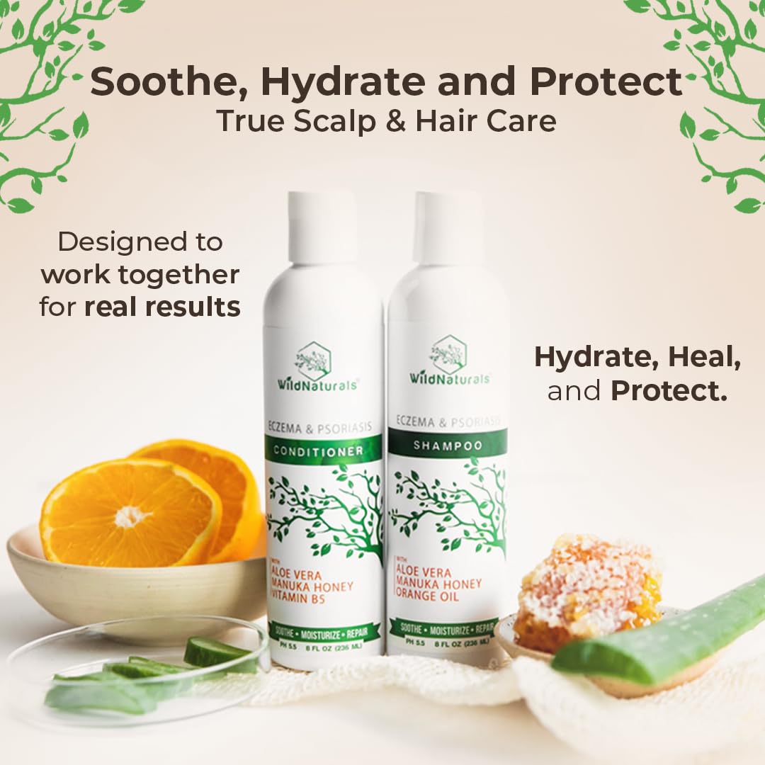 Wild Naturals Eczema and Psoriasis Treatment - Anti-Dandruff Deep Conditioner for Damaged, Dry Hair and Seborrheic Dermatitis Scalp