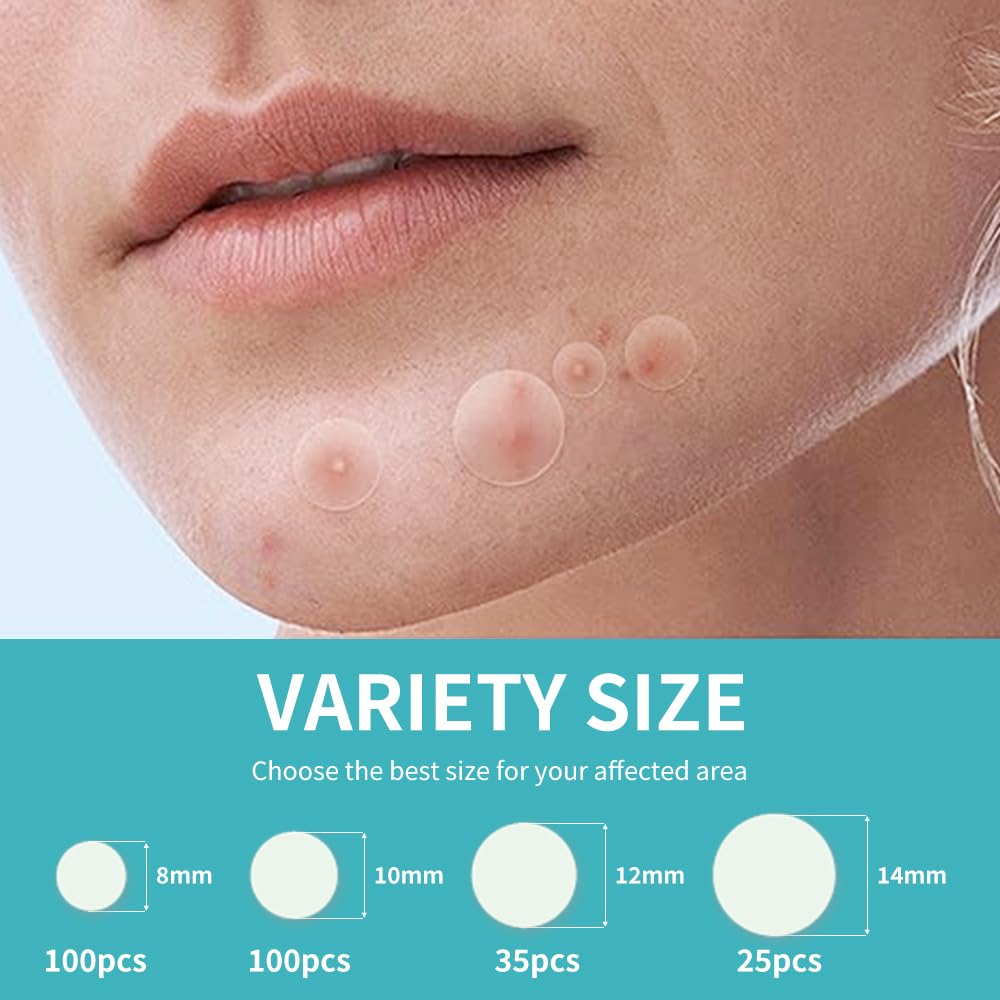 Safirst Sticky Acne Patches Hydrocolloid Pimple Absorbing Patch 4 Size 260 Counts Spot Blemish Invisible Stickers Zit Dot Cover Breakout Treatment