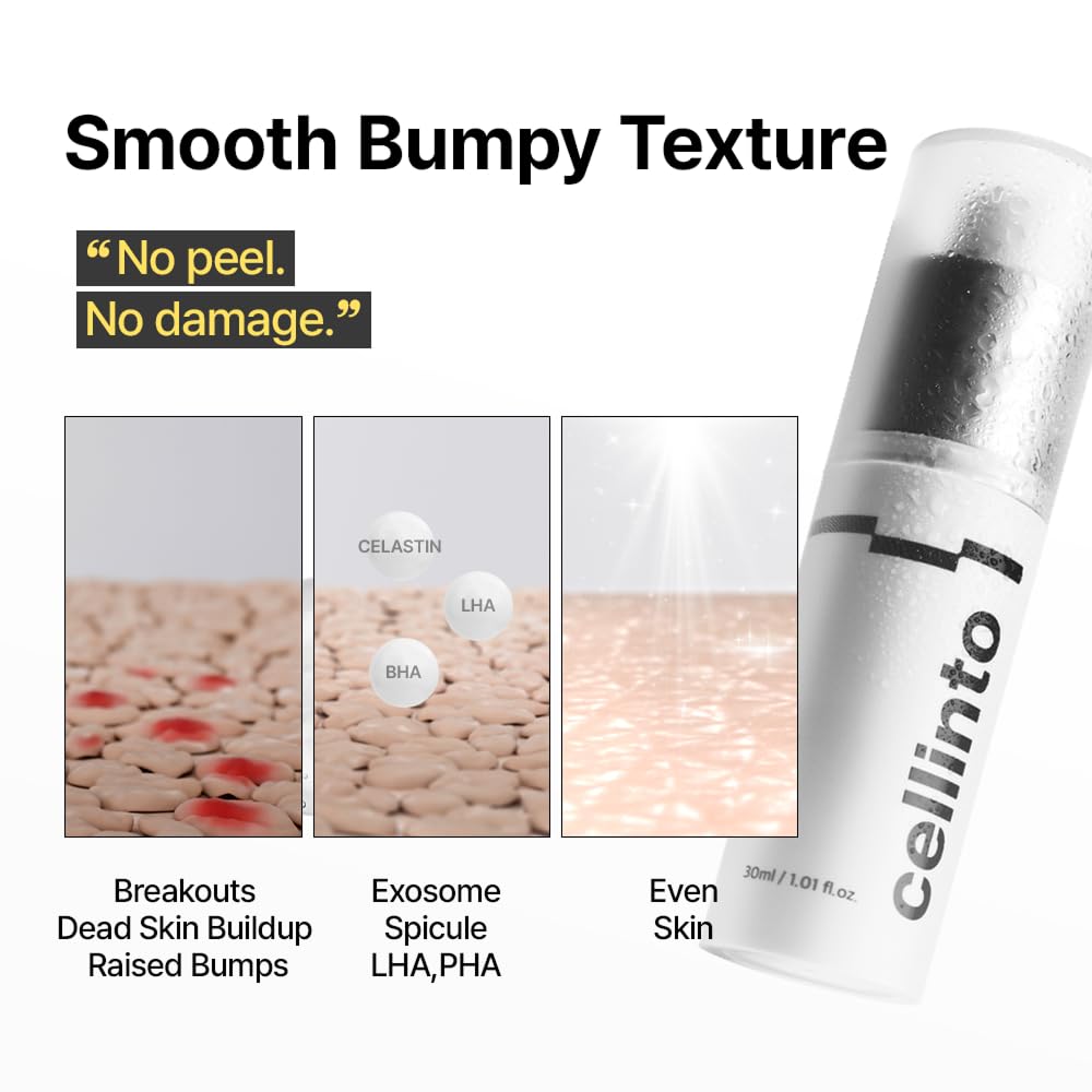K-Beauty Exosome Reset Ampoule – Gentle Exfoliating, Pore-Clearing & Blemish-Calming Serum for Sensitive Skin | Daily Clarifying Step (30ml)