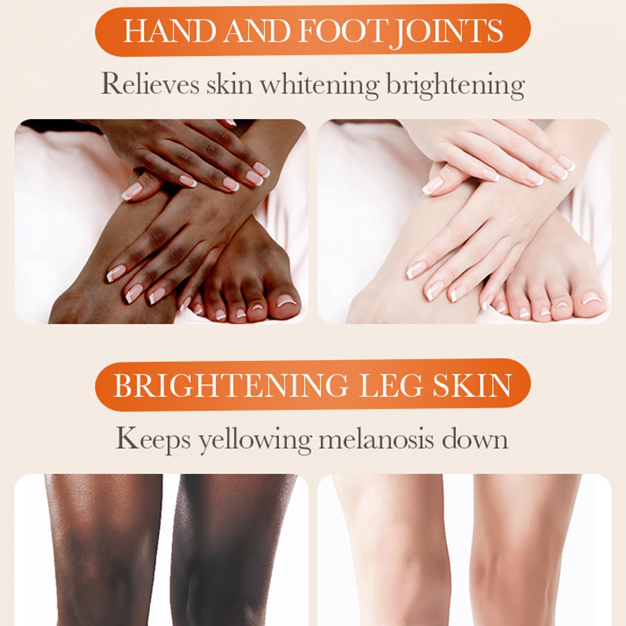 5.2oz Large Dark Knuckle Whitening Cream,Skin Bleaching For Dark Knees and Elbows,Body Moisturizing Strong Joint Whitening Cream for Clavicle,Neck,Niacinamide Vitamin C Dark Spot Corrector Remover
