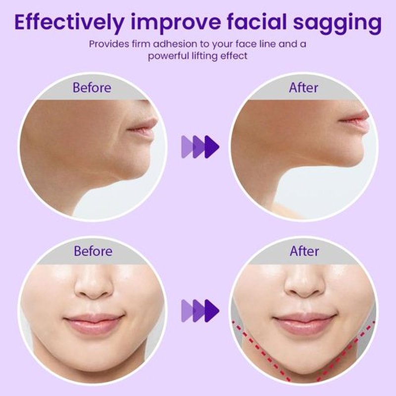 Kaely 8Pcs V Line Lifting Mask,Double Chin Mask,Chin Strap for Double Chin for Women,Face Lift Mask with Collagen,Hydrating Anti-aging,Red-Small Size