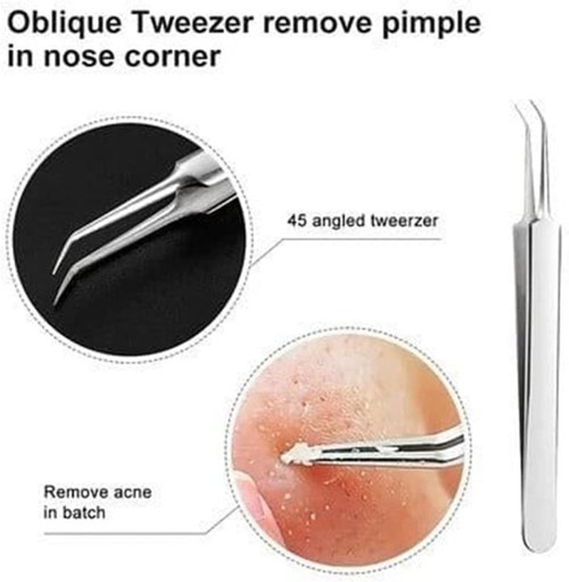 Usiveinborn Blackhead Remover, Usiveinborn Tweezers, Professional Facial Blackhead Remover Tweezers, Blackhead Remover Comedone Extractor (Straight-Mouth clamp)