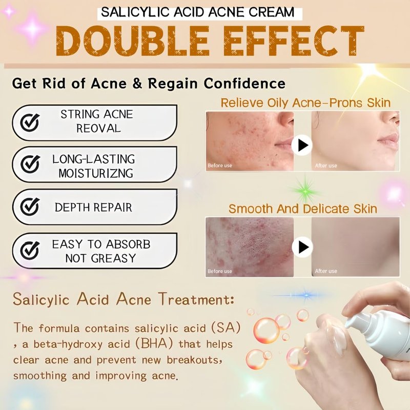Salicylic Acid Acne Face Cream for Oily & Sensitive Skin – Oil Control, Acne Treatment, Pore Minimizer, Moisturizing & Repairing Damaged Skin – Non-Comedogenic, Gentle Formula, 50ml / 1.69oz