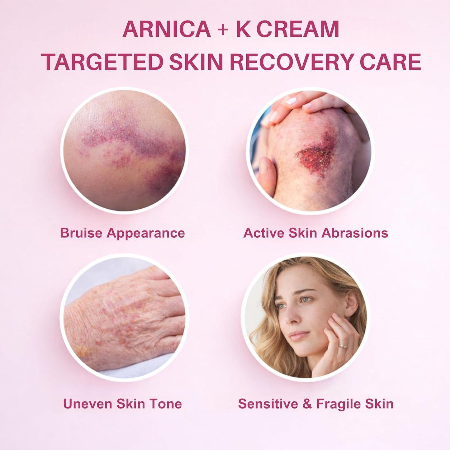 Bruise Cream with Vitamin K– Moisturizing & Firming Formula for Arms, Legs & Hands -4.23 oz|Restores Fragile Skin with Anti-Wrinkle Benefits (Fragrance Free)