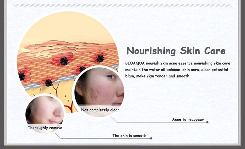 BIOAQUA Face Acne Treatment Scar Removal Spots Pimples Moisturizing Essential Oil 30ml