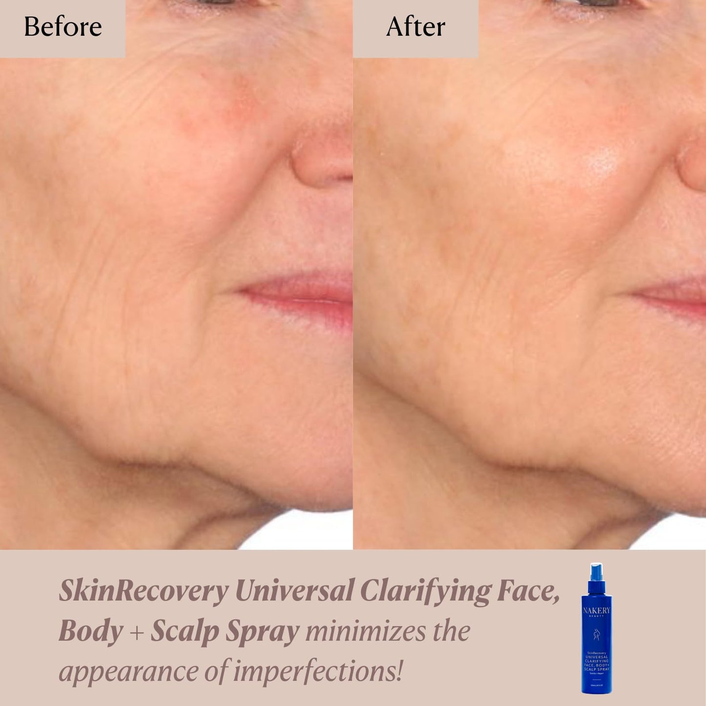 Nakery Beauty SkinRecovery Universal Clarifying Face Body And Scalp Spray With Hypochlorous Acid, Soothing pH Balanced Mist For Sensitive Skin, Helps Reduce The Look Of Redness, Made In USA