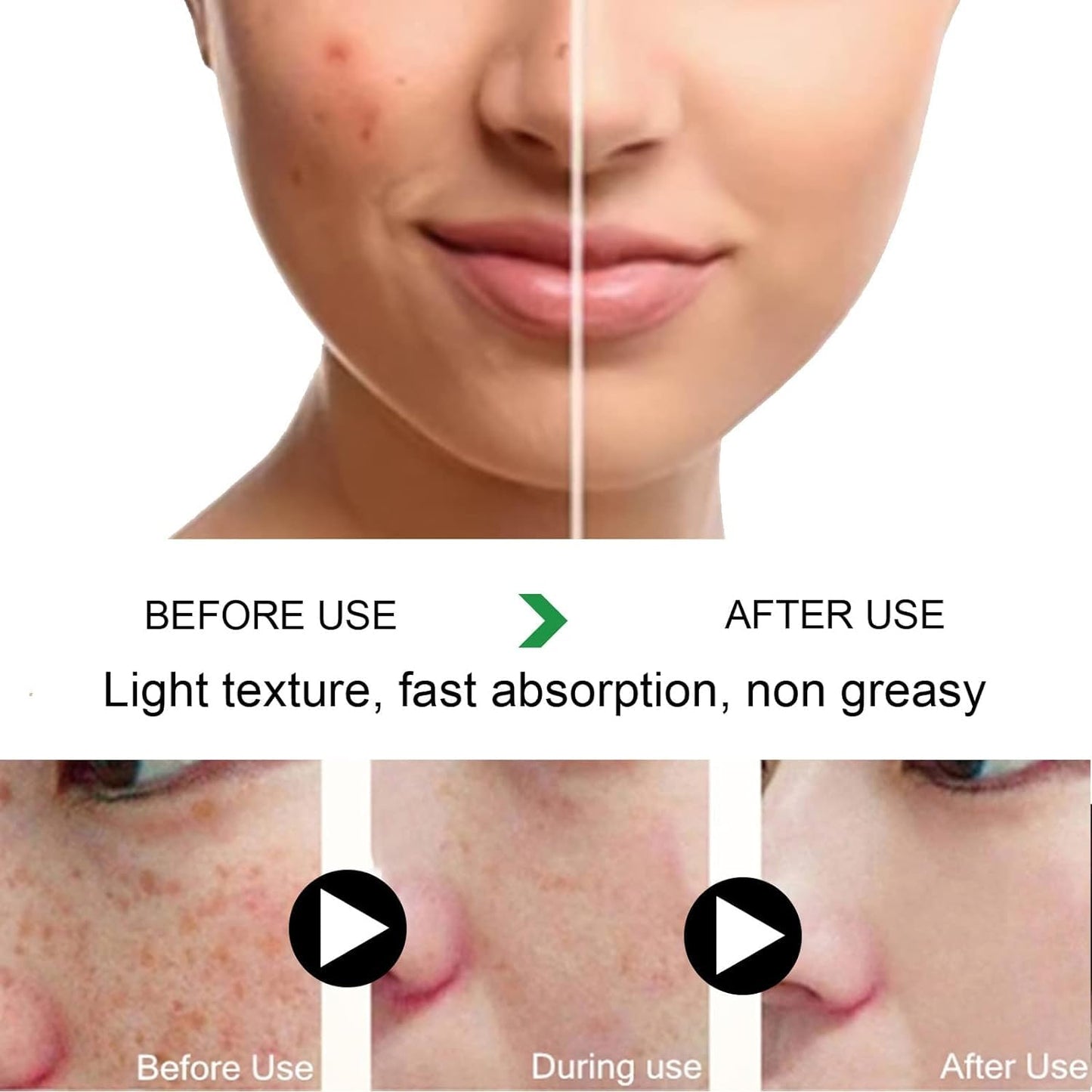RESOVTE Cremas Para Manchas En La Cara, Cream Skin Tone Imperfections Care, Cremas Para Quitar Manchas De La Cara, Crema Para Manchas En La Cara, Crema Para Las Manchas De La Cara (4PCS)