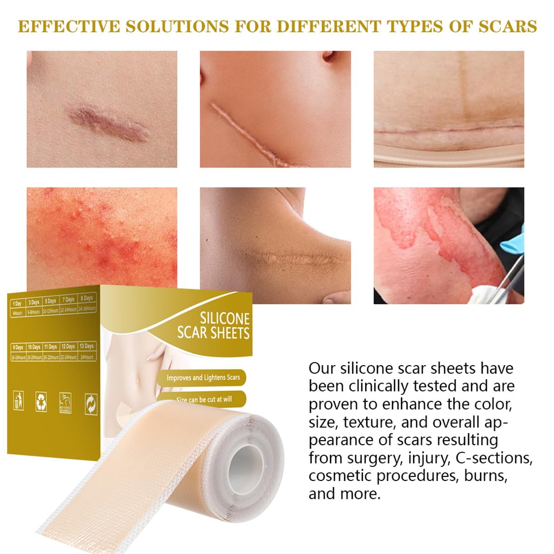 Silicone Scar Sheets, Scar Tape for Surgical 2inch X 118inch Silicone Skin Patches for C-Section Keloid Bump and Acne Scars Removal Treatment