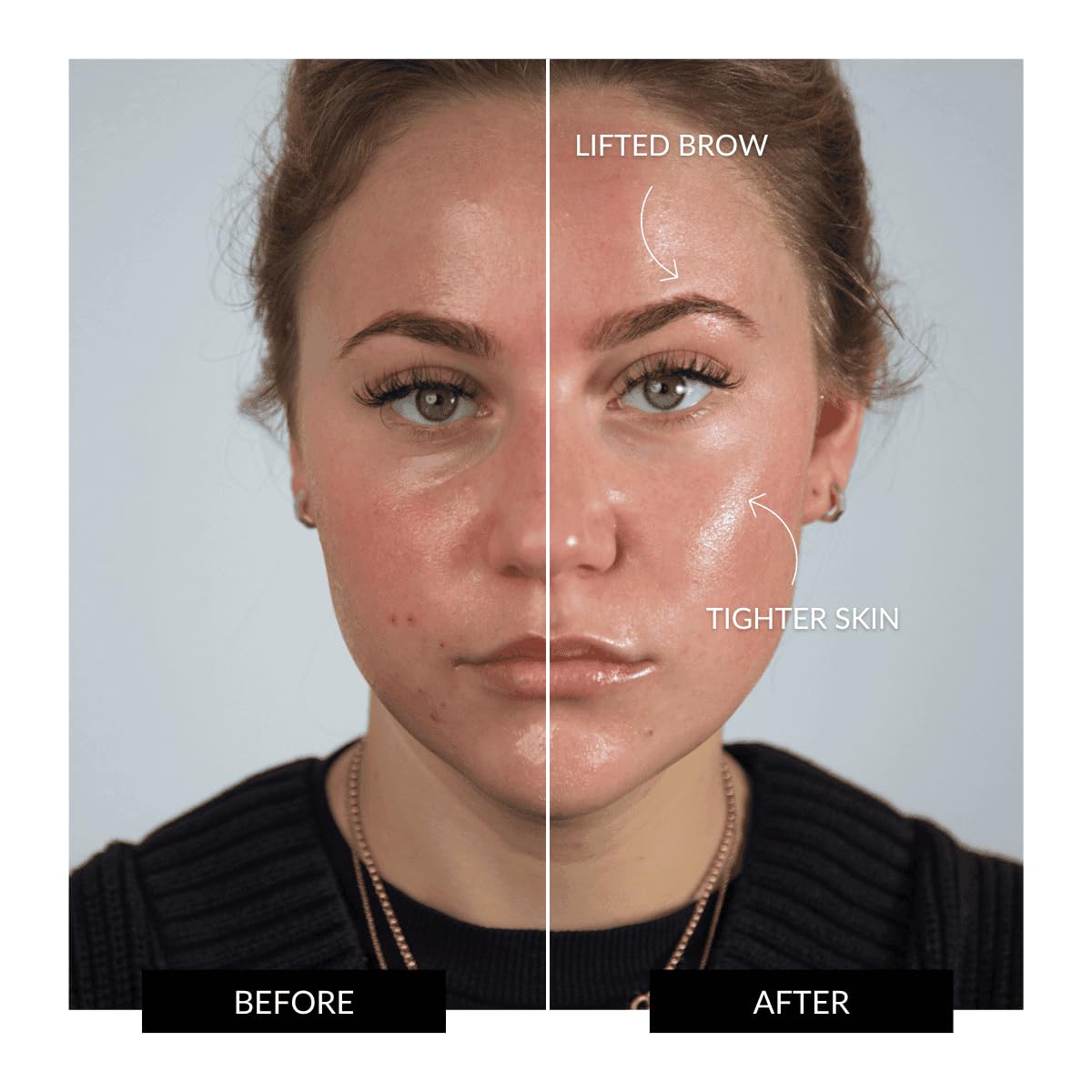 ZIIP Halo Facial Toning Device | Microcurrent and Nanocurrent Facial Device | Strengthening and Sculpting for Youthful, Glowing Skin | Anti-Aging at Home Use to Sculpt, Lift and Contour The Face