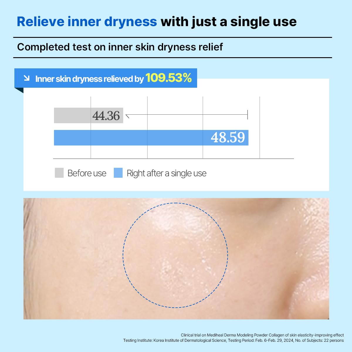 Mediheal Derma Modeling Pack (Hyaluronate)*2 - Deep Hydrating For Moist Skin - Easy DIY Home Spa Kits, Hydrating Icy Jelly Mask For Skin Refreshment