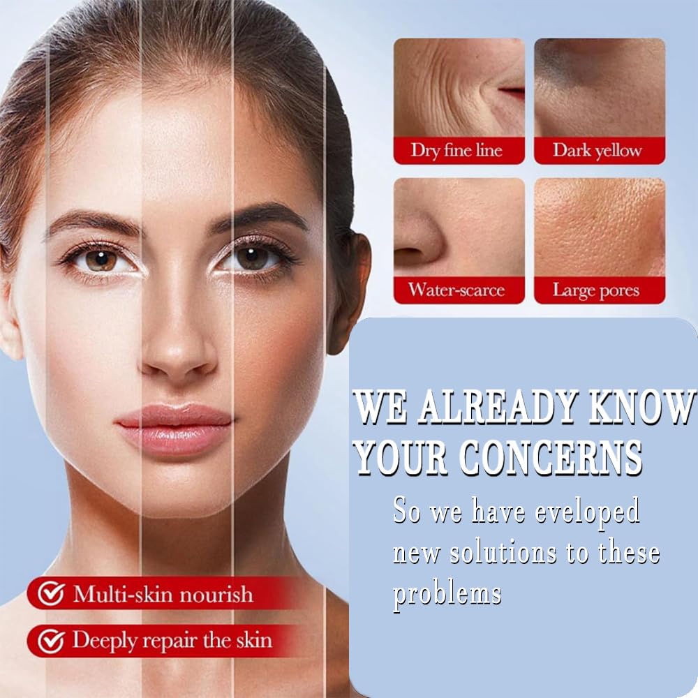 Kojic Acid Cream, Face and Body Gel, Dark Spots, Melasma, Natural Ingredients, Moisturizing and Mild Effect (1pcs acido kojico)