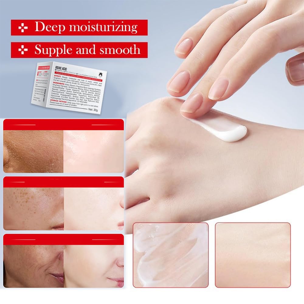 Kojic Acid Cream, Face and Body Gel, Dark Spots, Melasma, Natural Ingredients, Moisturizing and Mild Effect (1pcs acido kojico)