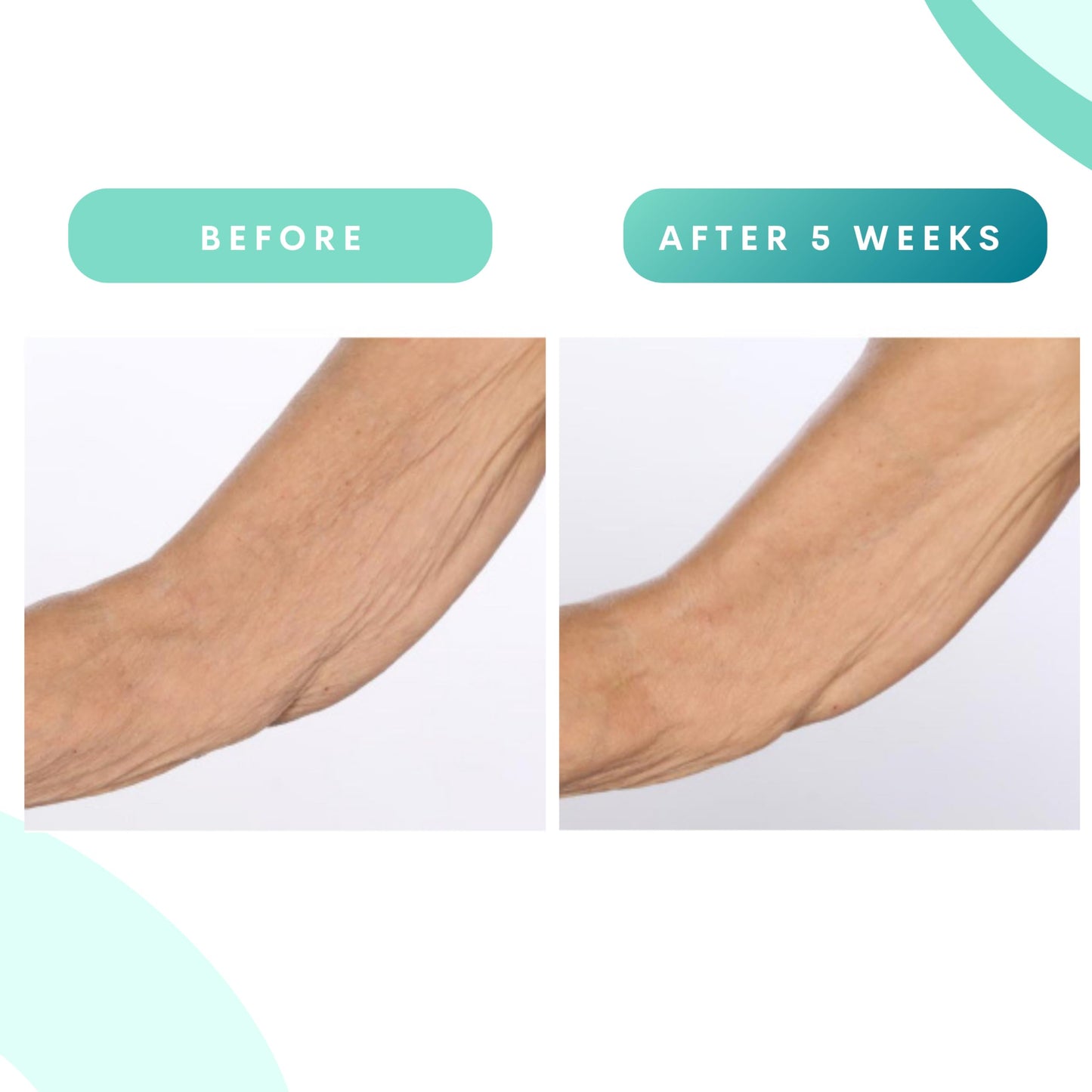 Serious Skincare, Glycolic Firming Retexturizing Body Cream with BODY FIT™, Moisturizing Lotion for Dry Skin, for Loose Crepey Skin Arms, Legs, Belly, Gentle Exfoliation for Smooth & Glowing Skin 8 Oz