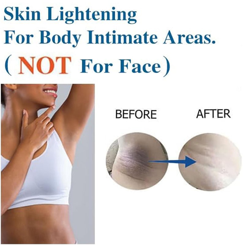 Skin Lightening Cream Gel - Niacinamide & Vitamin C for Body & Intimate Areas | 30ML