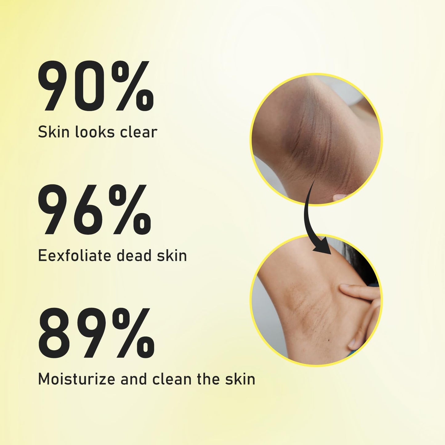 AOPEIBOTO Yellow Peeling Oil for Dark Skin, Extra Strong Peel Oil for Body Hands Arms Feet Legs Dark Knuckle Dead Skin Exfoliating, 3.38 fl.oz/100 ml