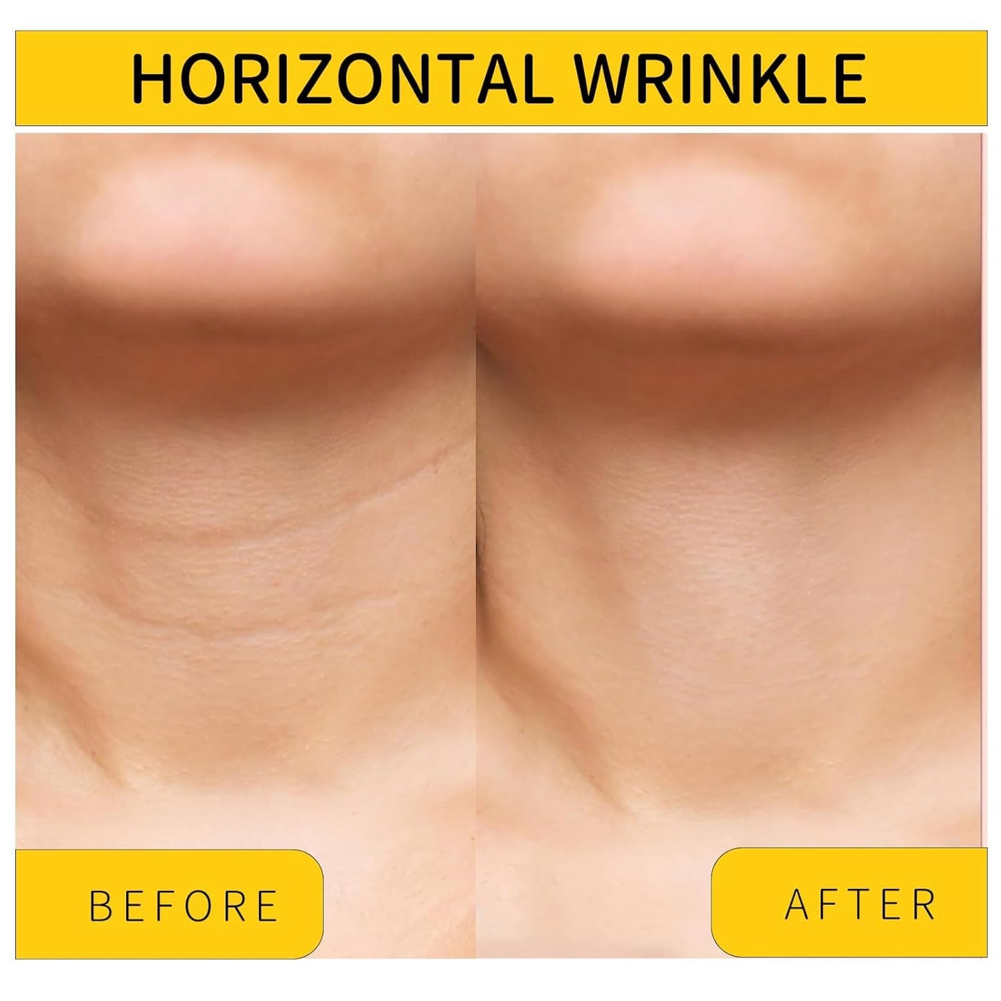 Irismistx Tighten and Lift Neck Firming Cream, Neck Creams for Tightening and Firming, Skin Tightening Cream for Face, Neck, Chest & Décolleté