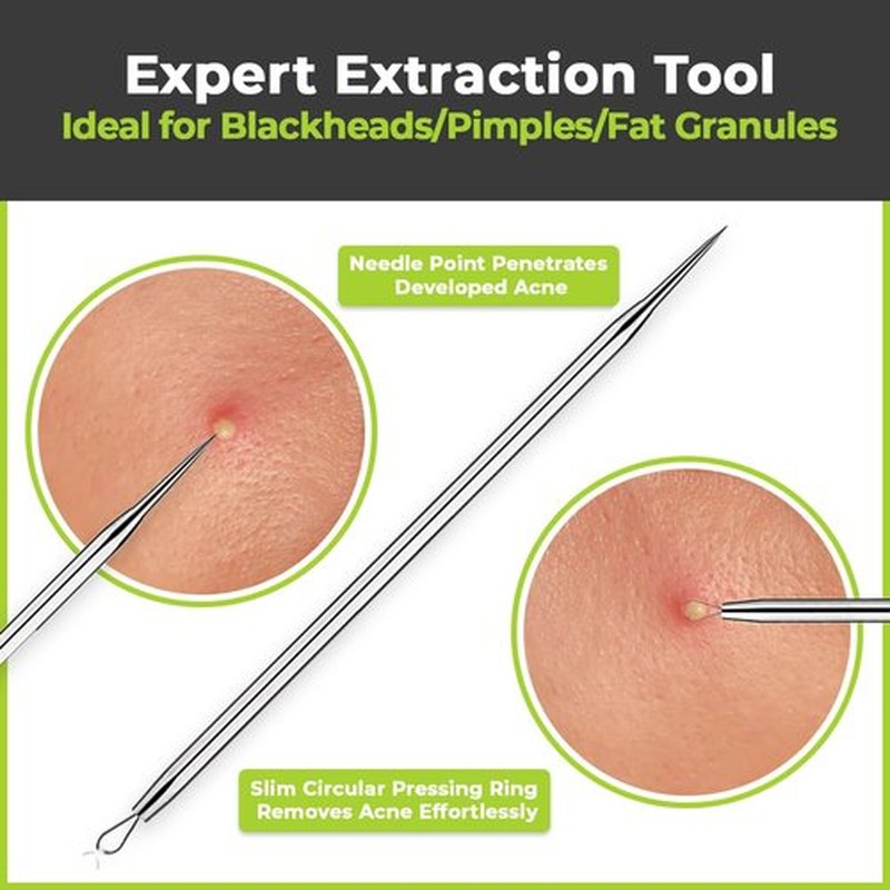 [6 Pcs] 2024 Latest Pimple Popper Tool Kit | Stainless Steel Blackhead Remover with Leather Case & Mirror for Acne, Blackheads, Whiteheads, Face & Nose