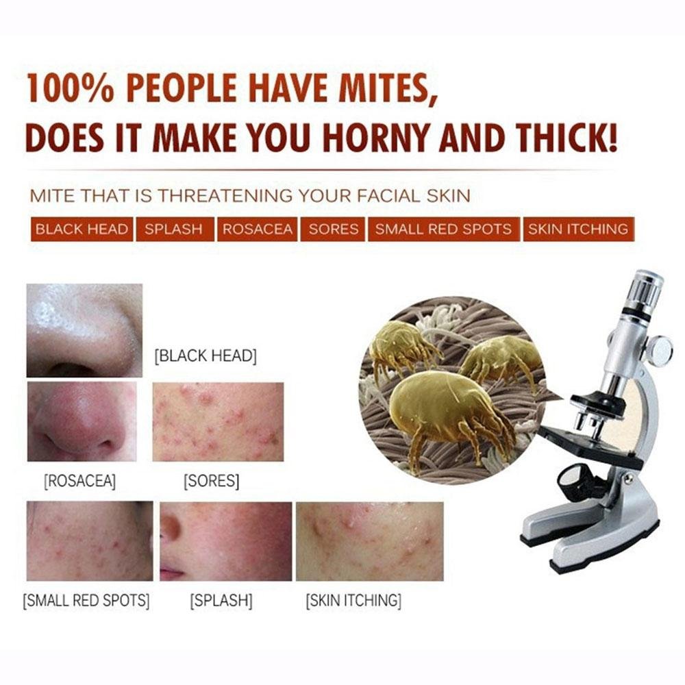 BIOAQUA Acne Scar Blemish Gel Spot Removal Oil Control Face Cream