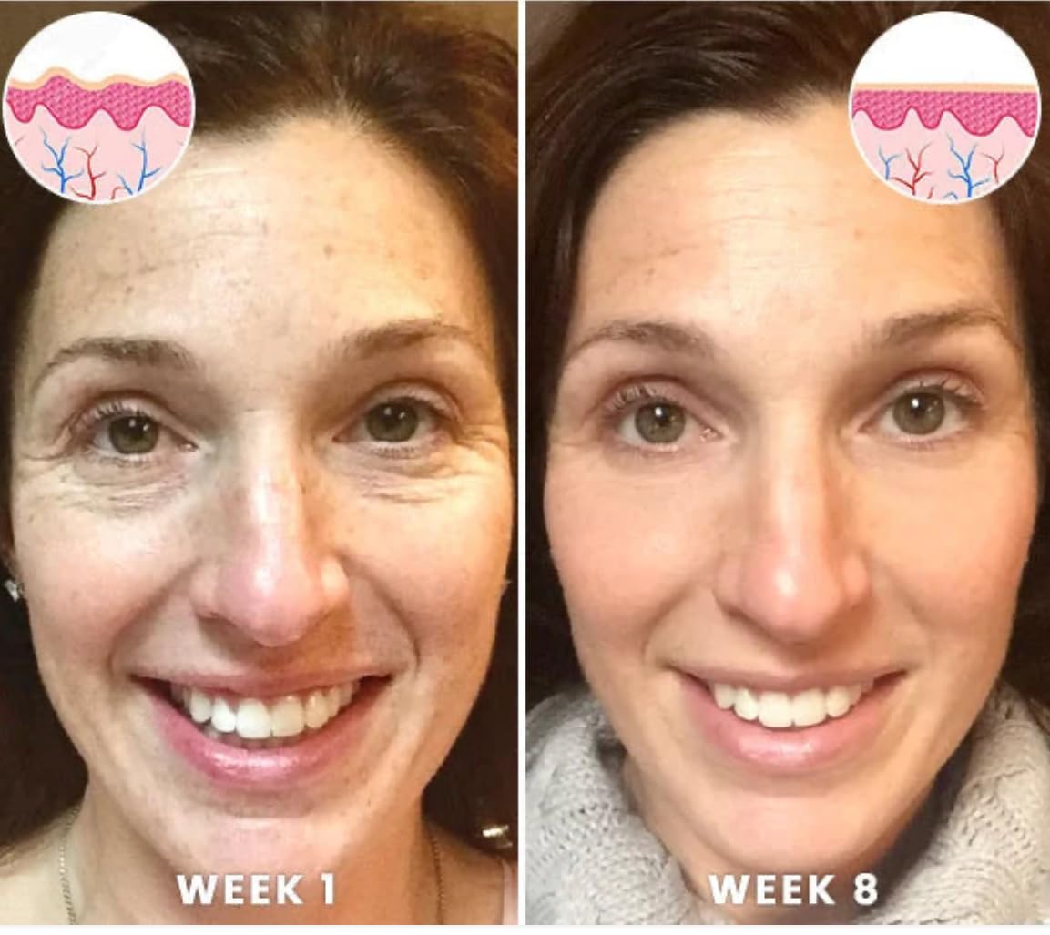 ReNew You Essentials Squalane and Vitamin C Rose Serum. Anti Aging Anti Wrinkle Brighten, Hydrate, Firm and Reveal Radiant Skin 1.0 ounces