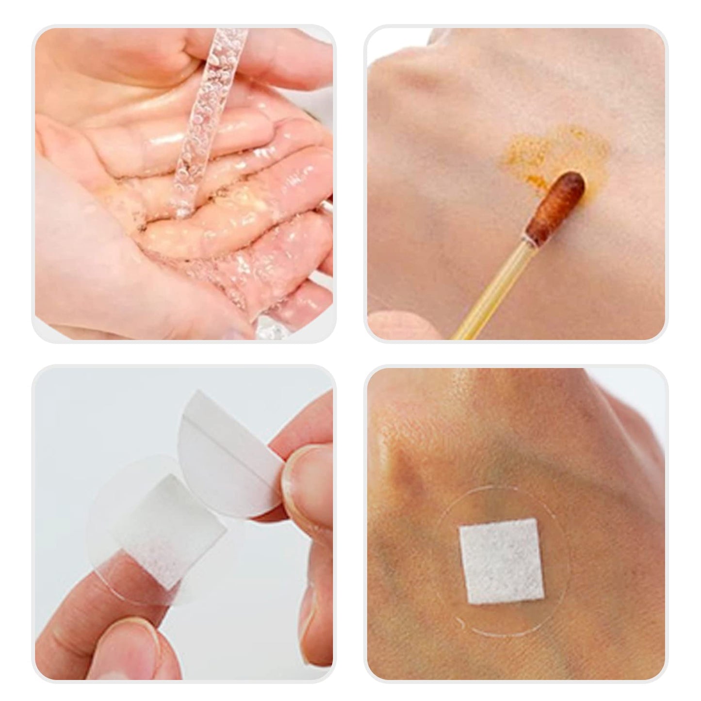 AndicAge 100pcs Adhesive Spot Bandage 1 Inch Clear Round Adhesive Bandages with Non-Stick Pad for Hands, Arms Small Wounds, 1 Box