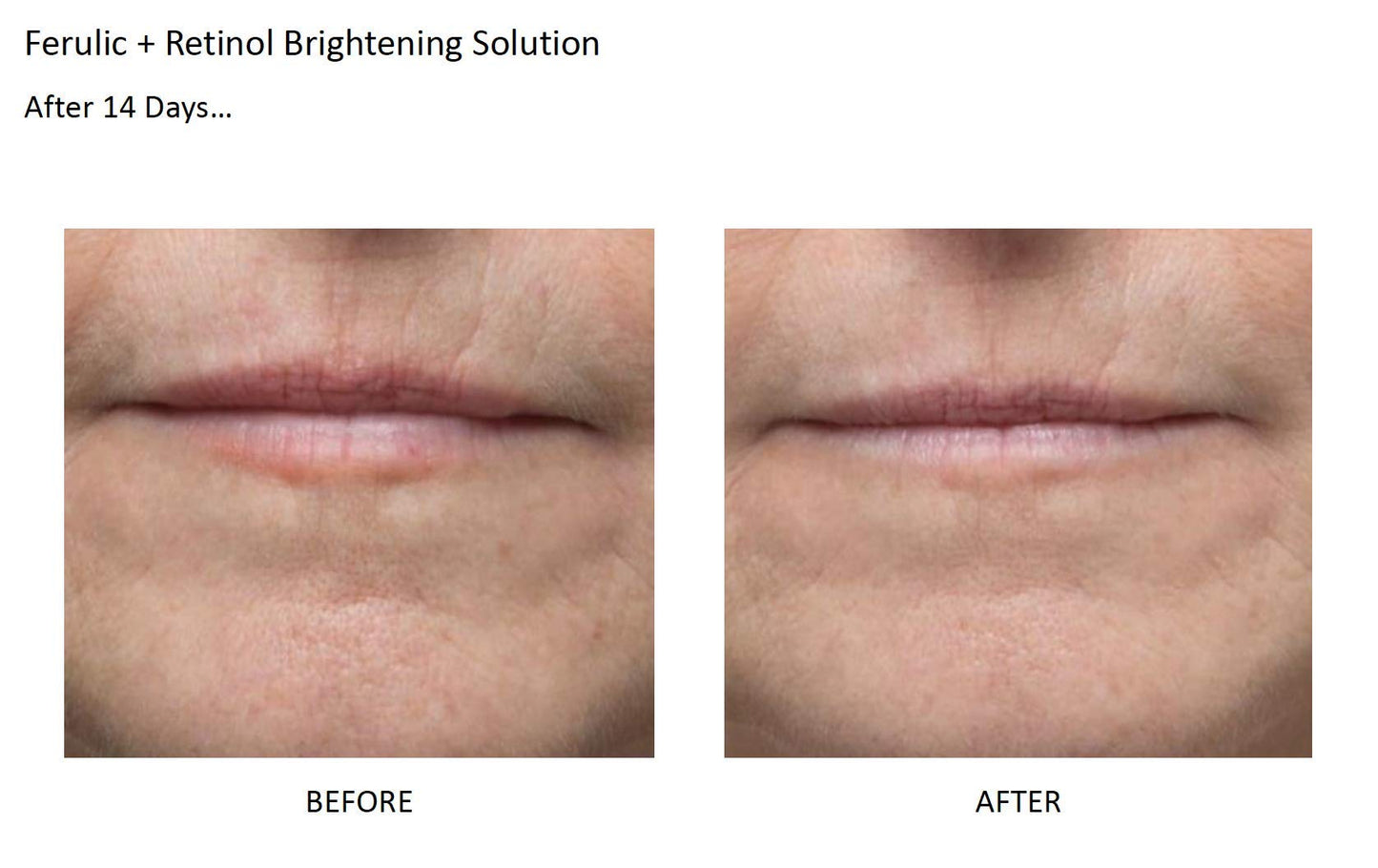 Dr. Dennis Gross Skincare Ferulic + Retinol Brightening Solution: for Fine Lines, Rough Texture, and Uneven Tone, 1.0 fl oz