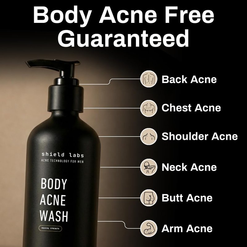 Shield Men's Acne Body Wash for Back, Chest & Shoulders - 4% Benzoyl Peroxide Body Wash, Clears Breakouts & Acne Scars – Unscented with Niacinamide, Glycolic Acid & Ceramides, 8.5 oz