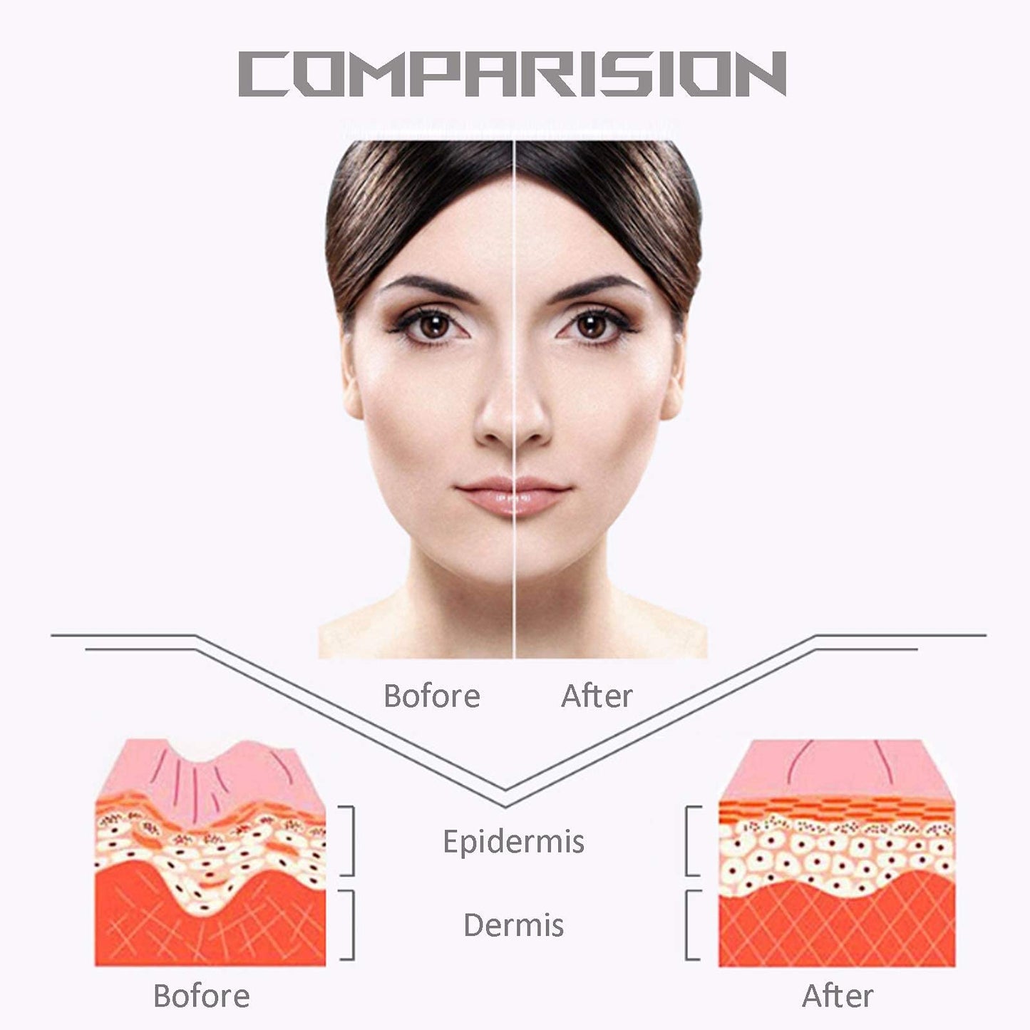 Permotary 5 PCS V Shaped Facial Masks V Line Chin Lift Patch Chin Up Tightening Mask Great for Chin Up & V Line, Double Chin Reduce, Firming Moisturizing & Contour Lifting