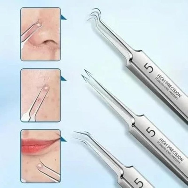Professional Facial Blackhead Remover Tweezers, Precision Pimple Popper Tool Kit for Whitehead Ance Blemishs Comedones (Set B)