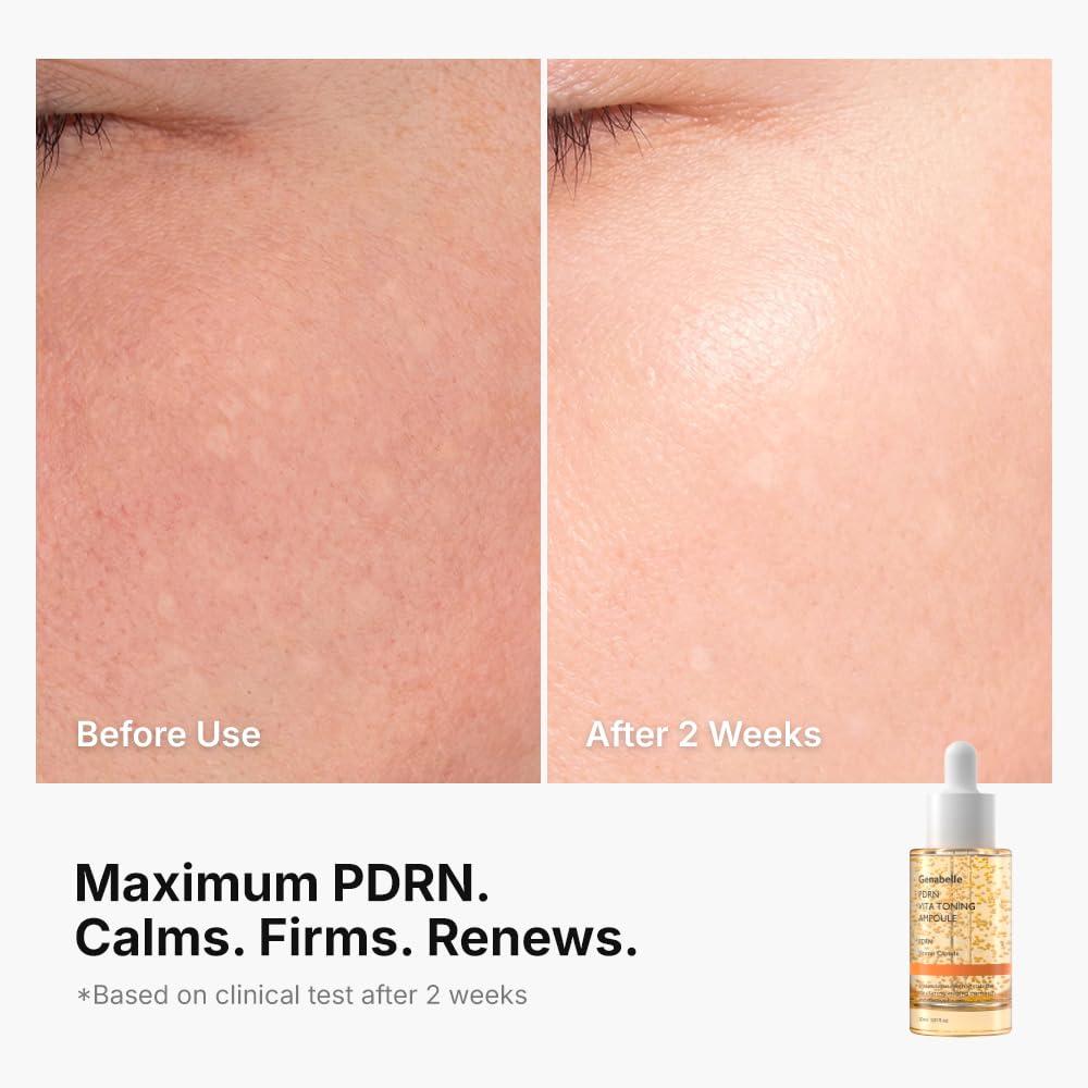 Genabelle PDRN Vitamin c Serum Toning Ampoule - Lightweight Glass Skin,korean skin care with Vitamin B, C, E, PDRN, Serum for Blemishes, Glass Skin, Fine Lines and Rough Skin Texture, 1.01 fl oz