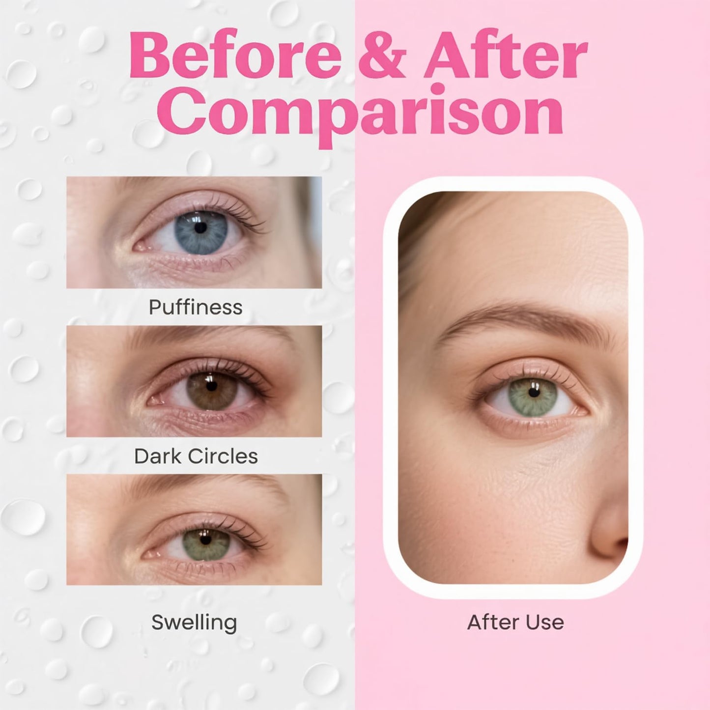 Soulagers Eye Gel Pads, Ice Packs for Eyes, Under Eye Ice Pack, Gel Ice Pack, Cooling Eye Masks, Gel Eye Mask for Puffy Eyes, Migraine, Puffiness(6 pcs)