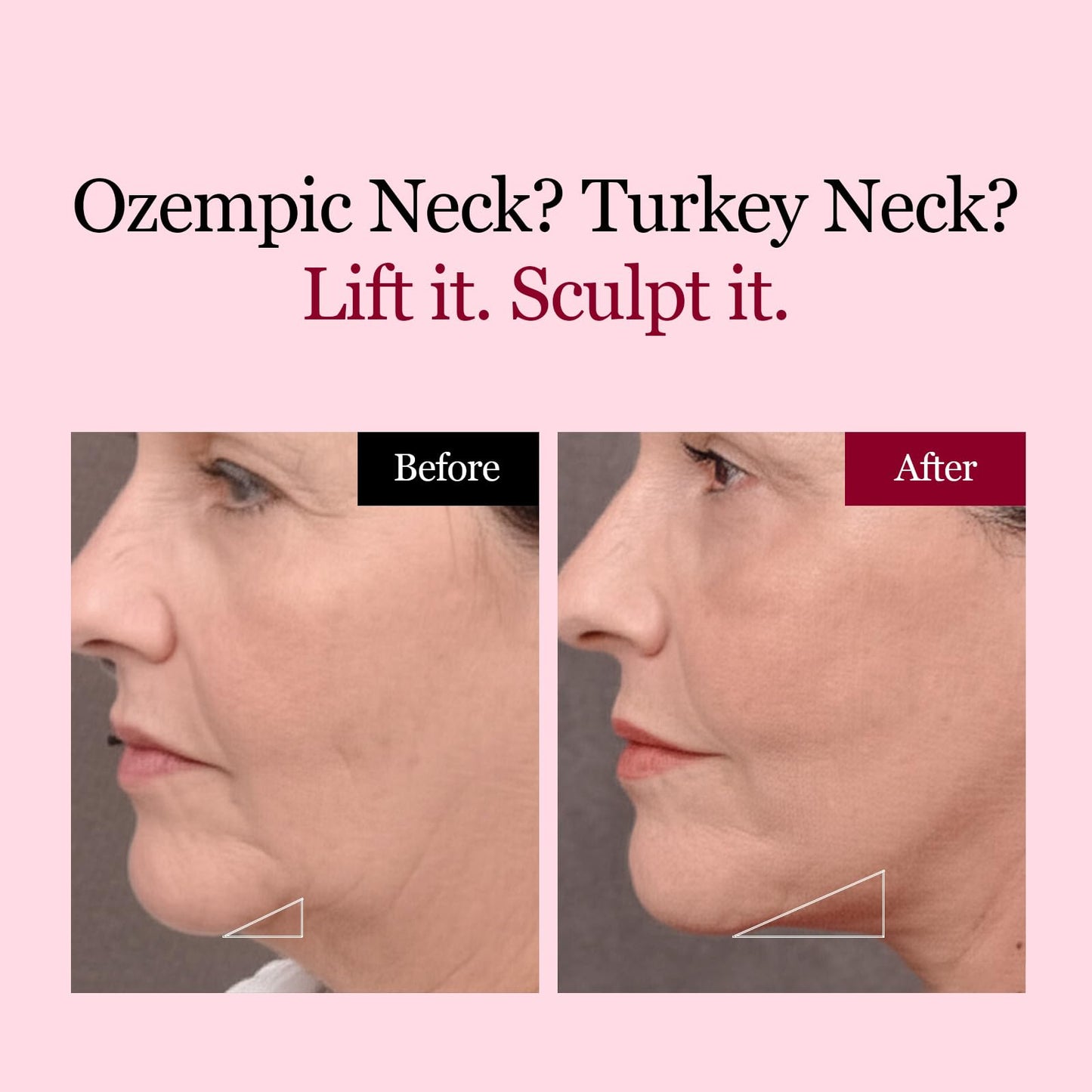 ROUND LAB Camellia Deep Collagen V Lifting Gel Mask 4ea | Double-chin Turkey Neck Instant Face Lifting Mask, Cooling and Depuffing Face Toning Belt, Firming Sagging Skin, Korean Skin Care, 10g/0.35oz