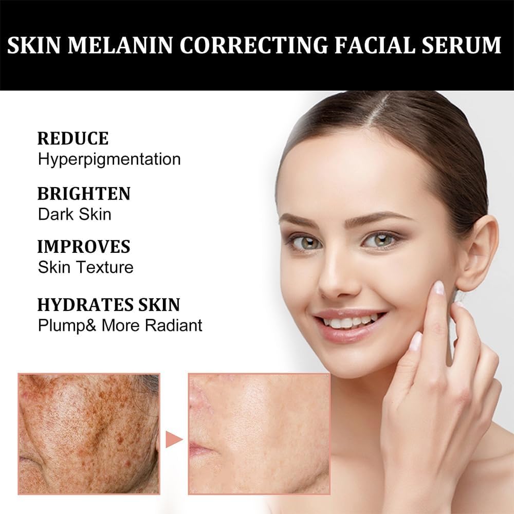 Melanin Correcting Facial Serum, Dark Spot Corrector Daily Face Serum, Melanin Correcting Facial (3pcs)